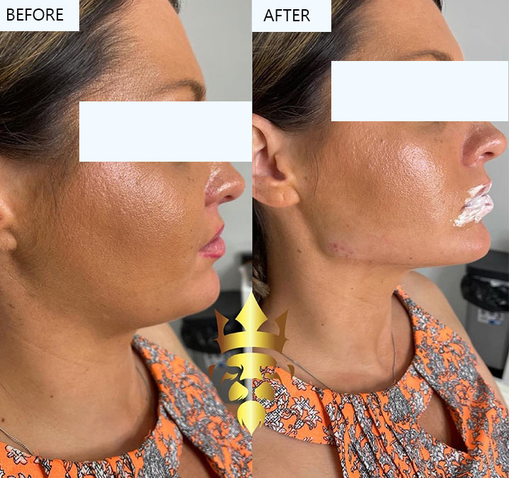 Faceshaping-Images-01