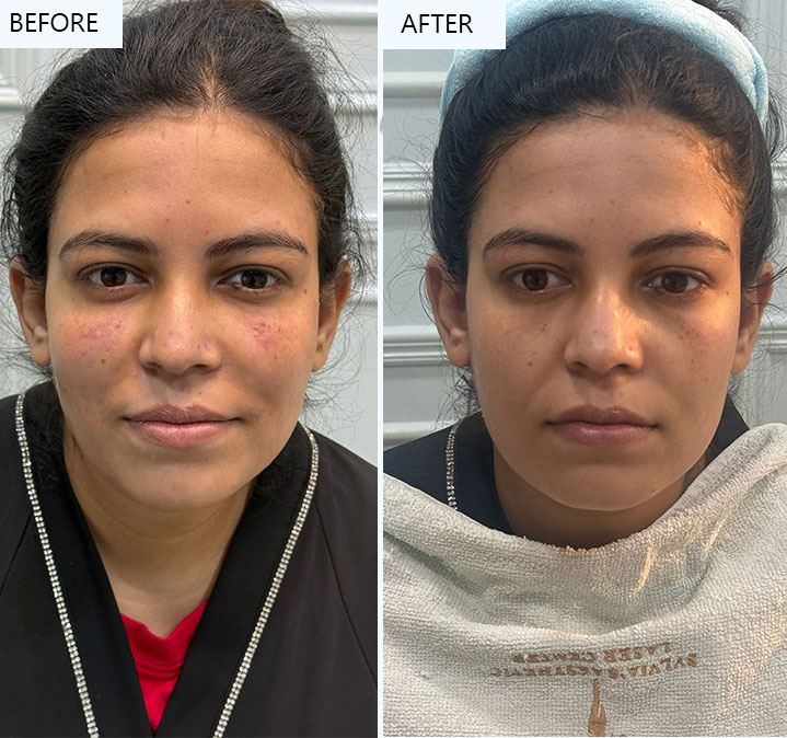 Faceshaping-Images-02