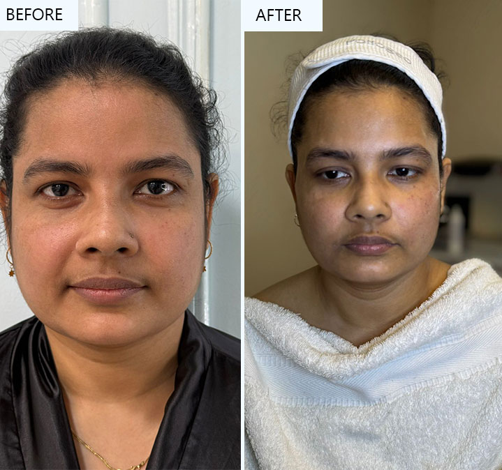 Faceshaping-Images-03