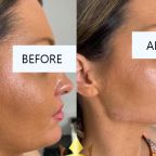 Faceshaping-Images...