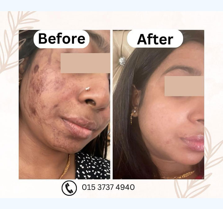 Spot-remove-images..