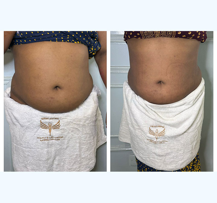 Belly-slimming-&-shaping-01