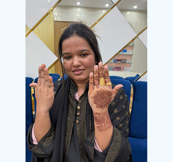 Glutathione-&-face-prp-images-01