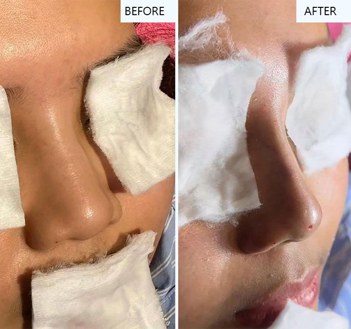 Glutathione-images-02