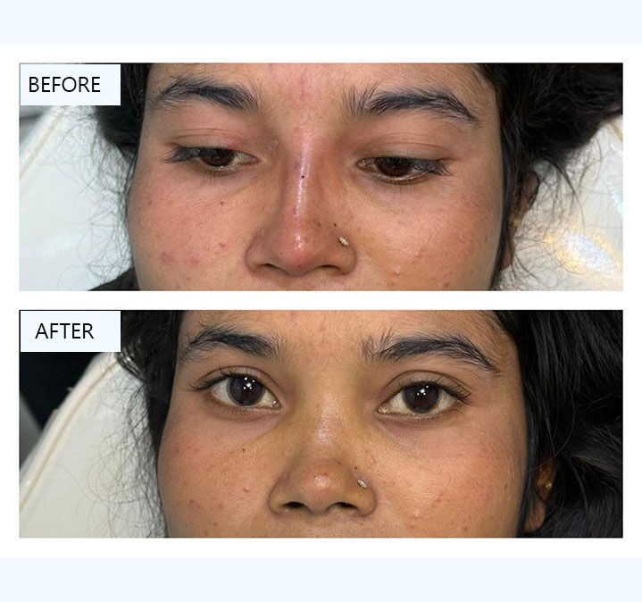 Glutathione-images-03