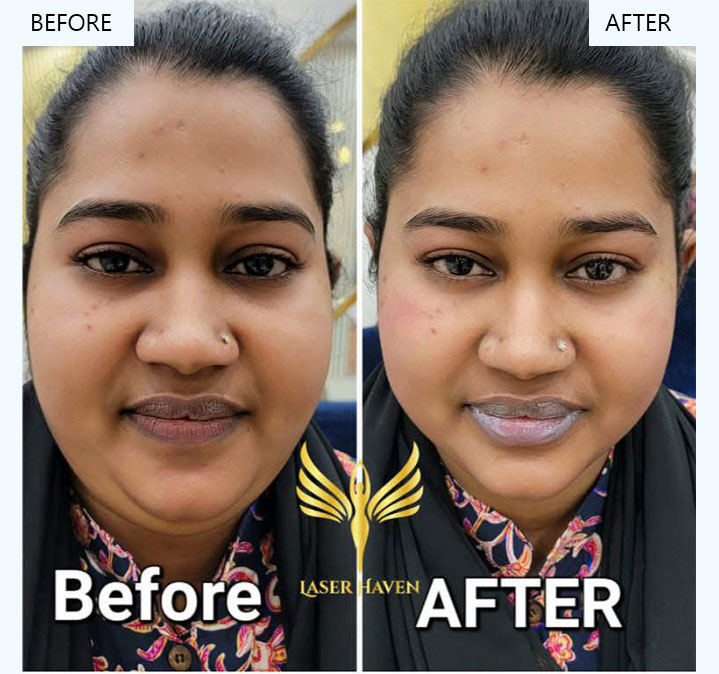 Glutathione-images-04