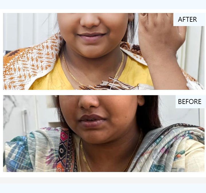 Glutathione-images-05