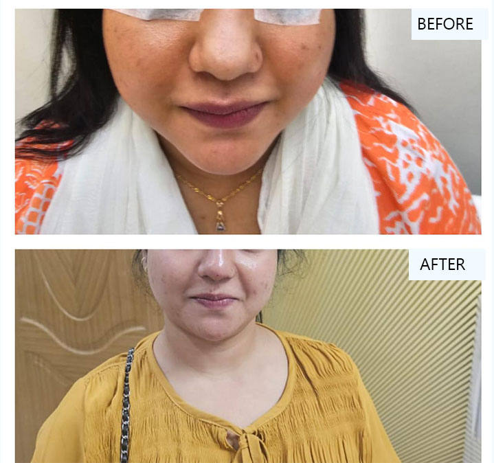 Glutathione-images-06