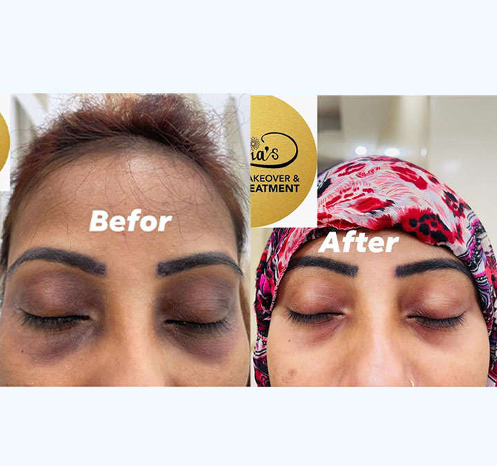 Double-chin-remove-02