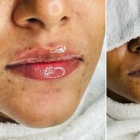 Lips-Filter-images--01
