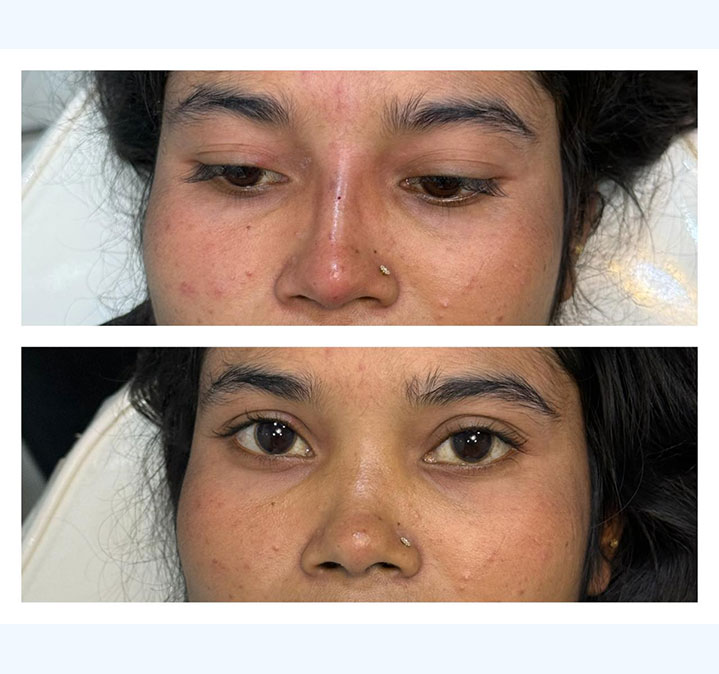 Nose-Shapes-images-02