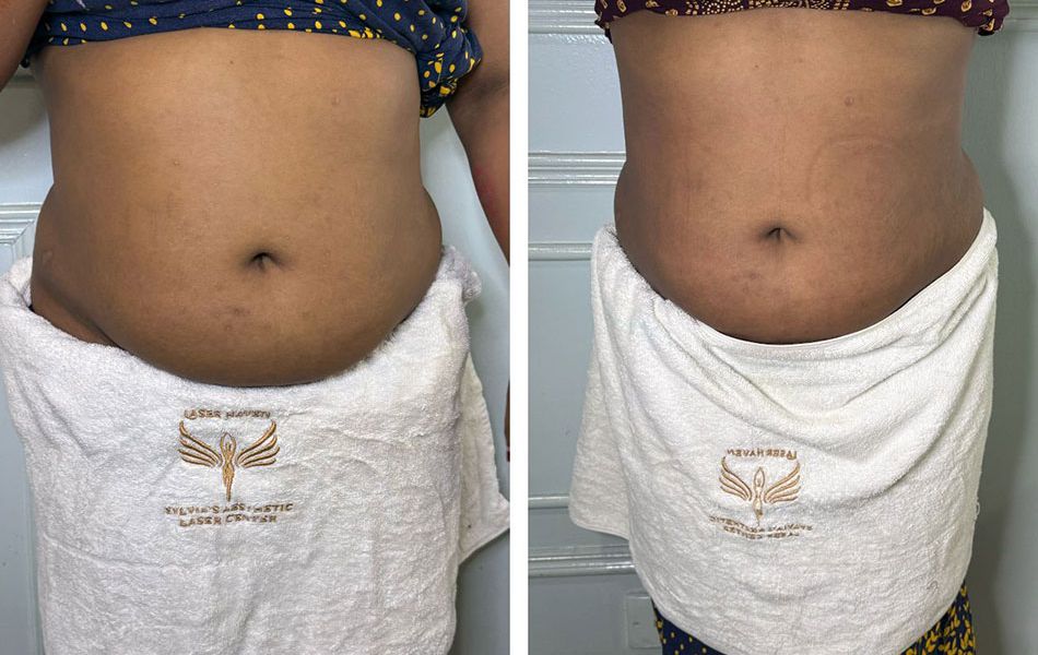 Belly-slimming-&-shaping--images