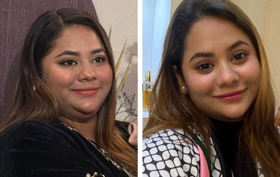 Double-chin-remove-08