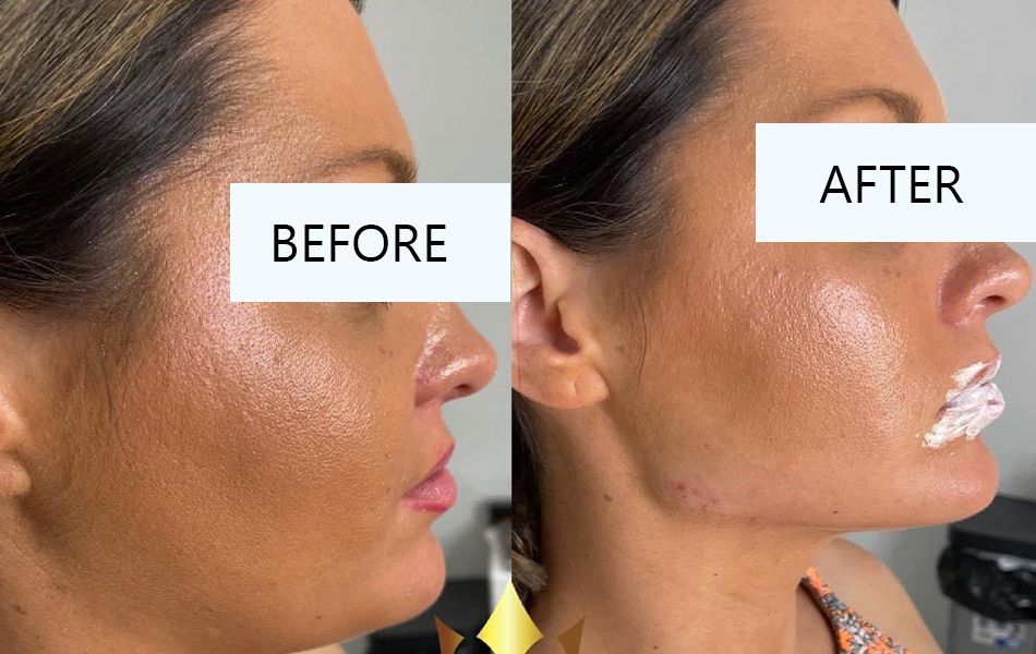 Faceshaping-Images...