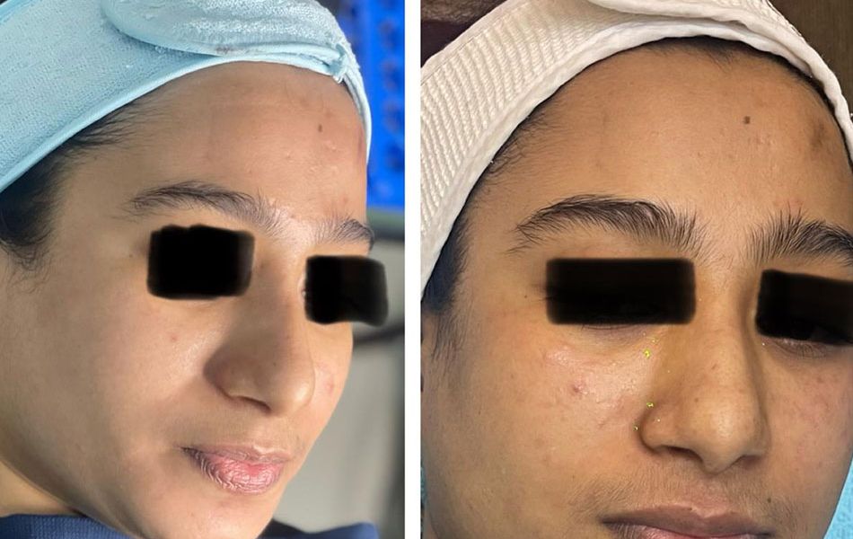 Skin-glow-treatment-image-01