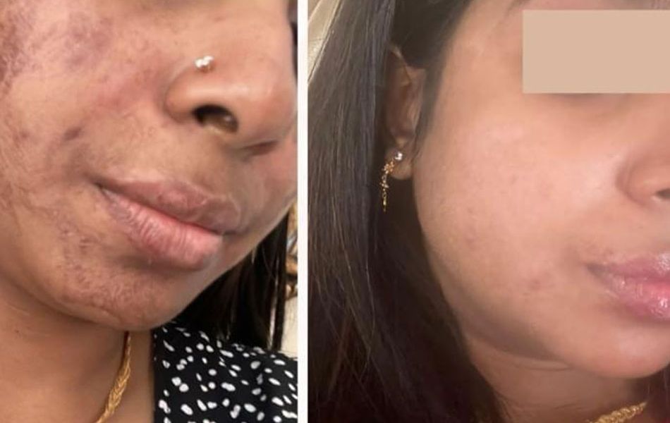 Spot-remove-images-01